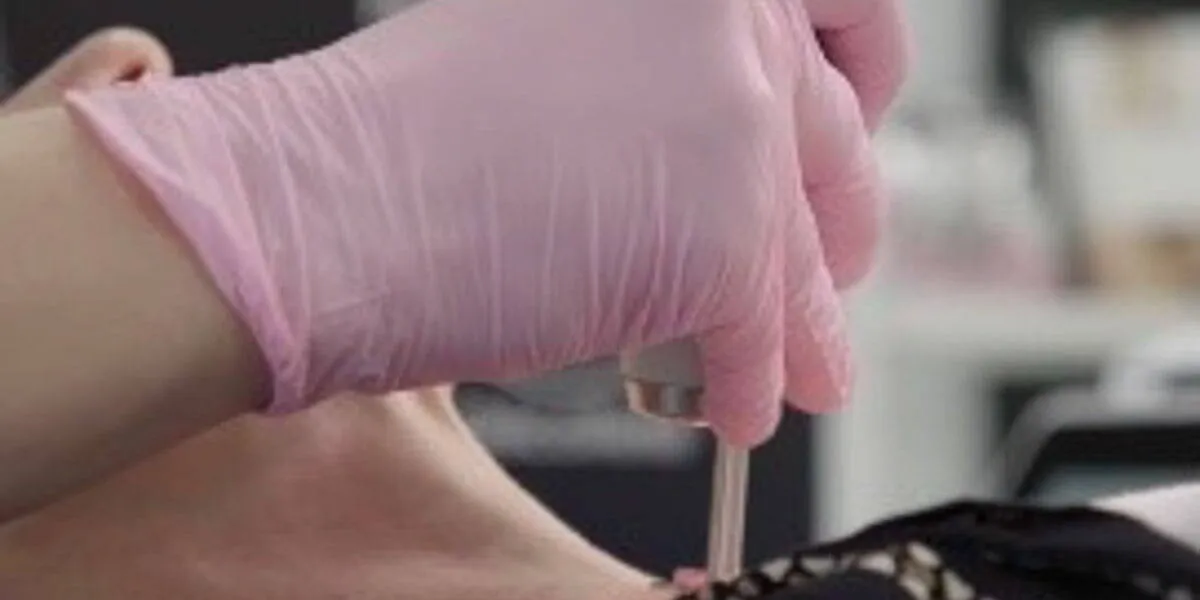 Neck Decolletage Laser treatment on neck area at Beauty Refined, Greenwood Village.