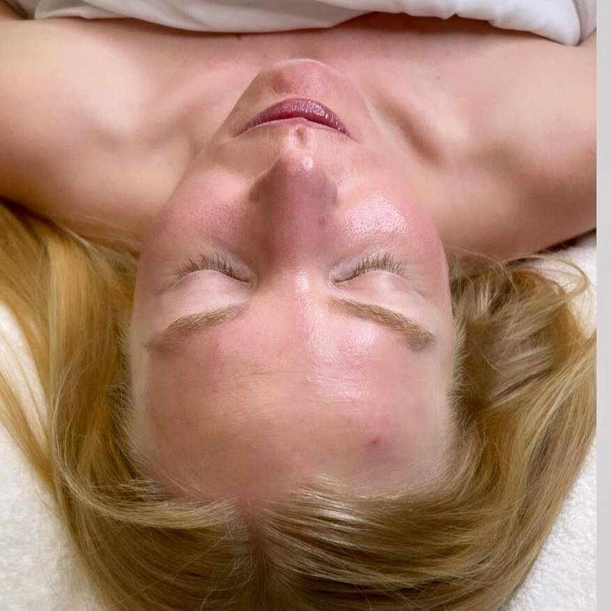 Glow Facial by Beauty Refined in Denver Tech Center, & Parker Colorado