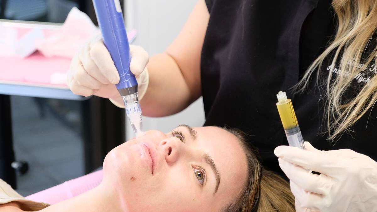 SkinPen microneedling device with PRP at Beauty Refined.