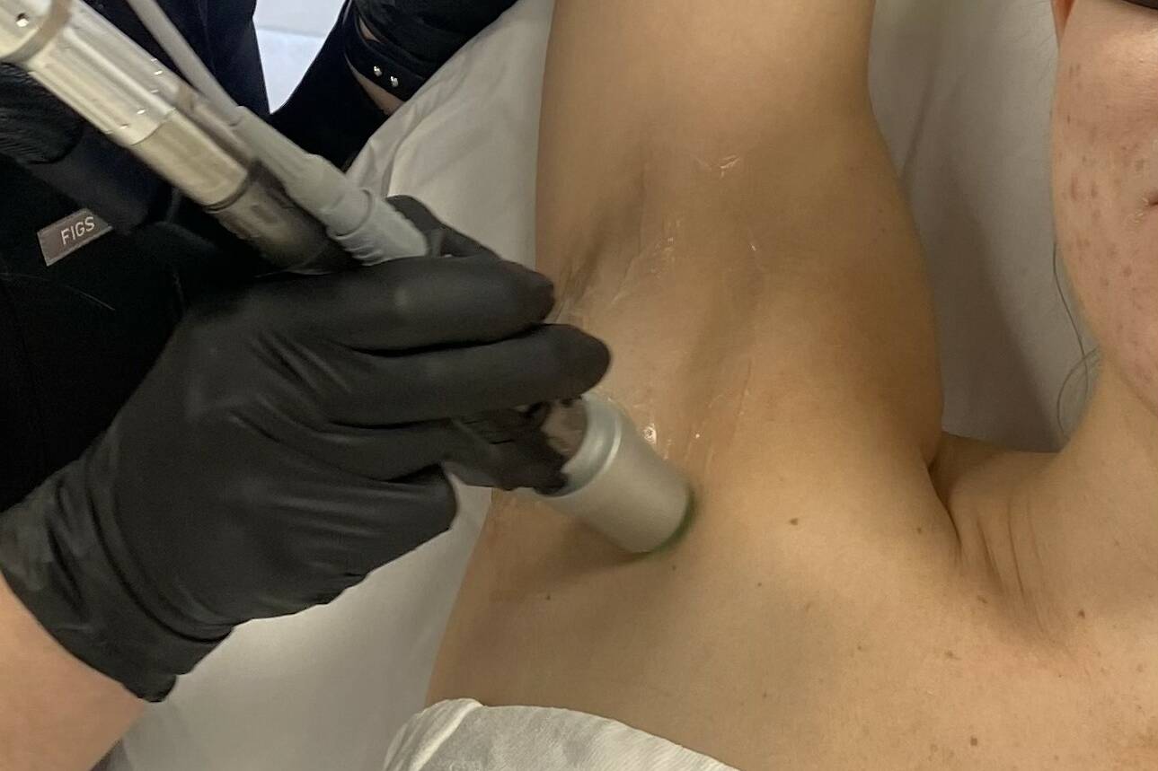 Chrome Laser Hair Removal by Beauty Refined