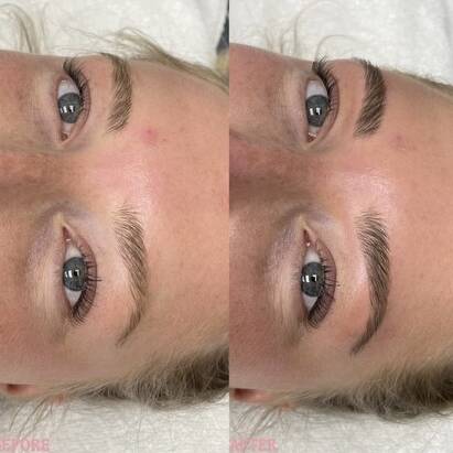 Before and After Gallery | Beauty Refined