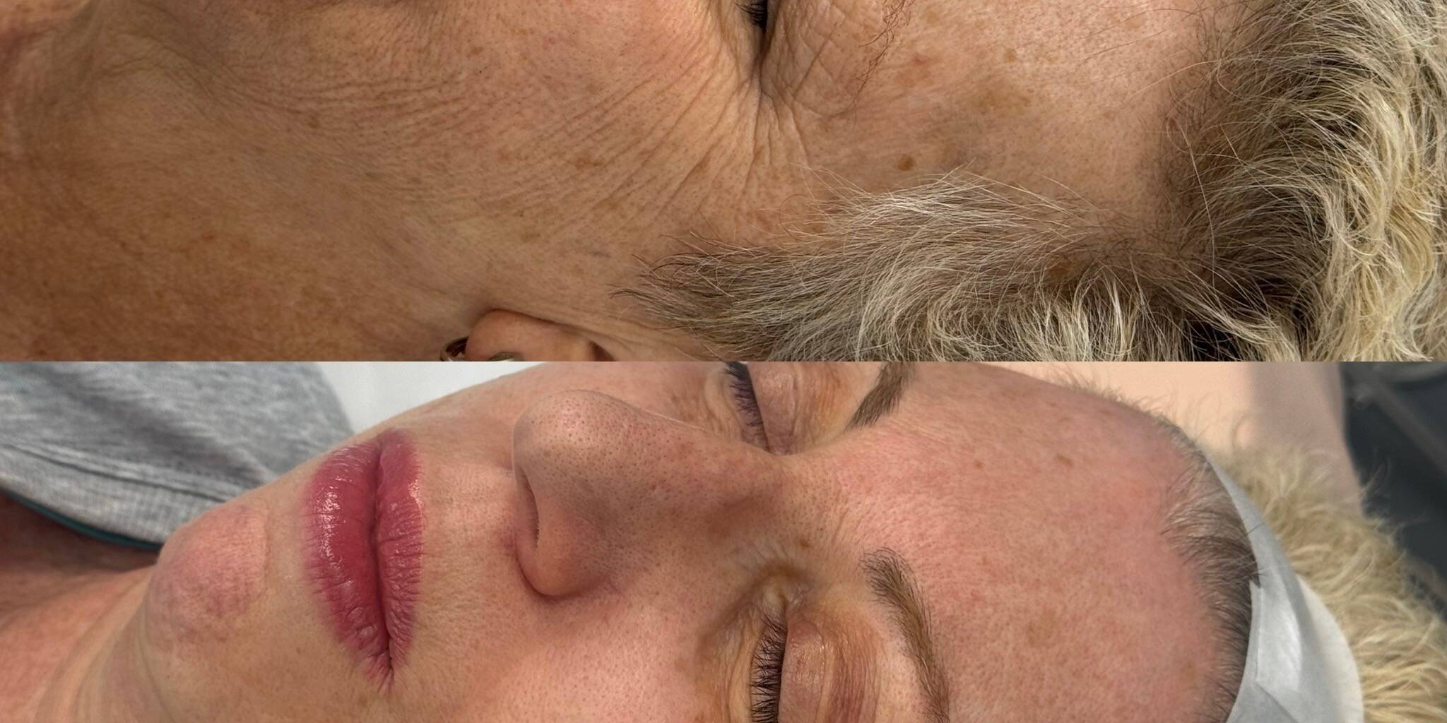 Before and After Gallery | Beauty Refined