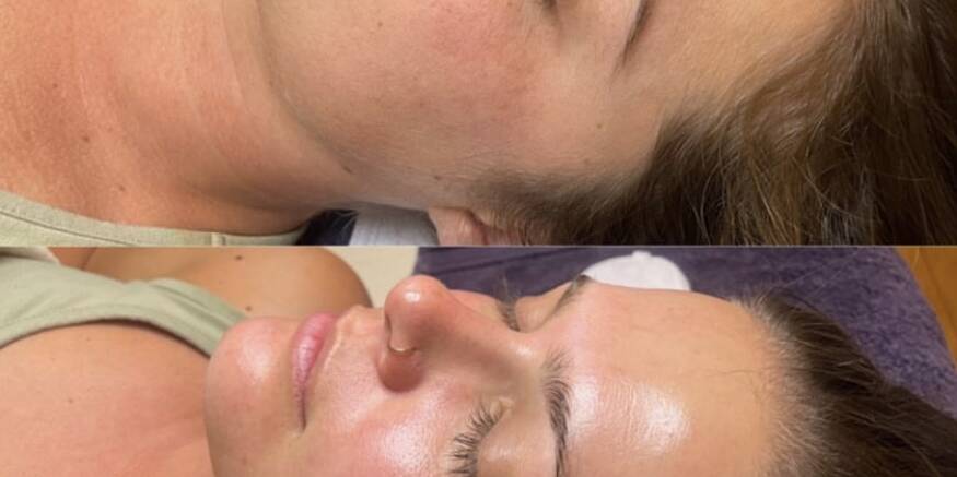 Before and After Gallery | Beauty Refined