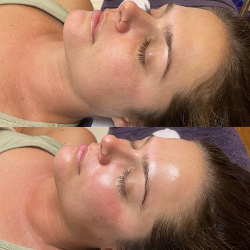 Before and After Gallery | Beauty Refined