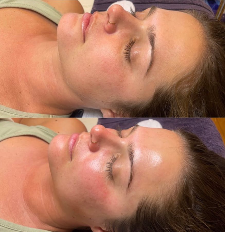 Before and After Gallery | Beauty Refined