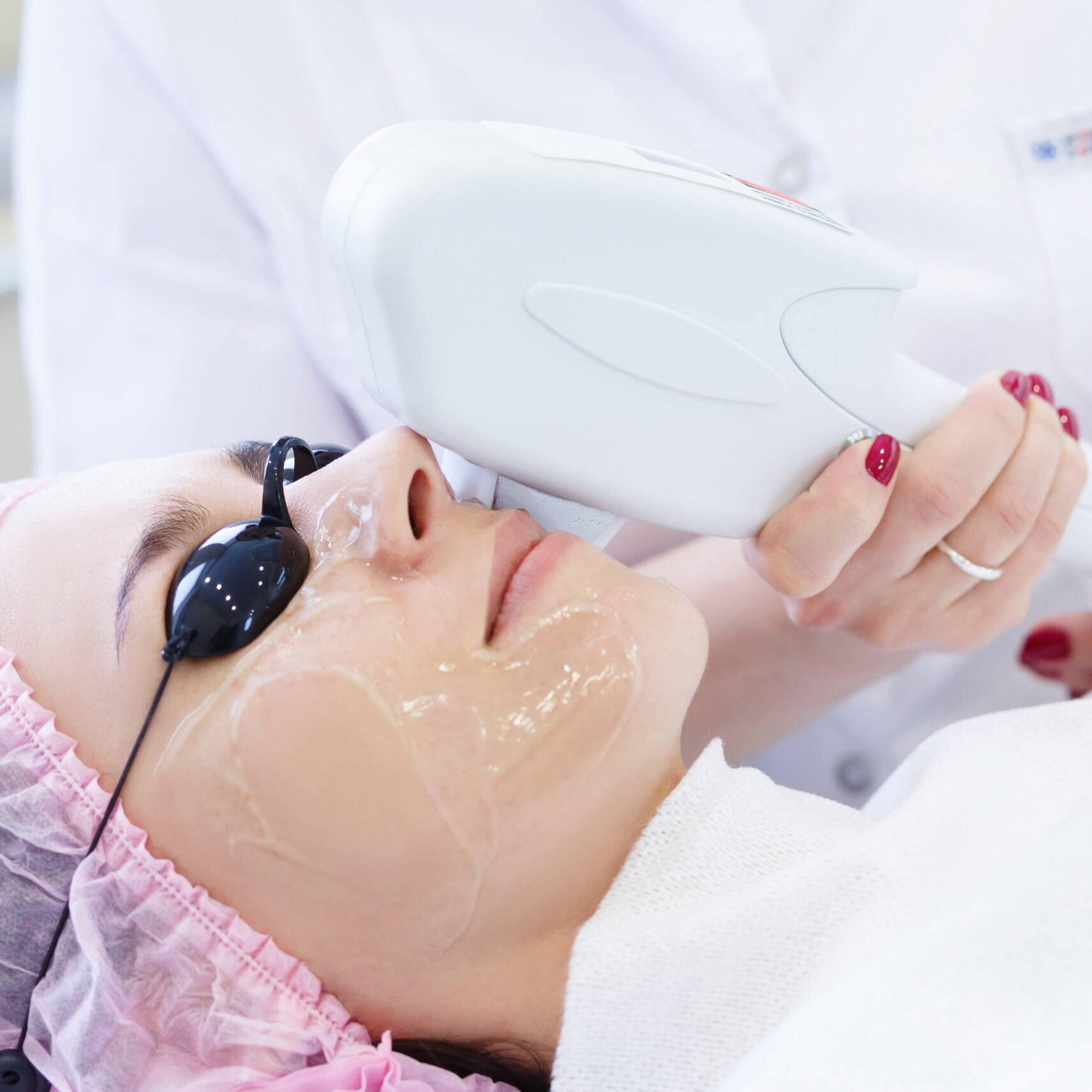 Skin care pigmentation removal by Beauty Refined