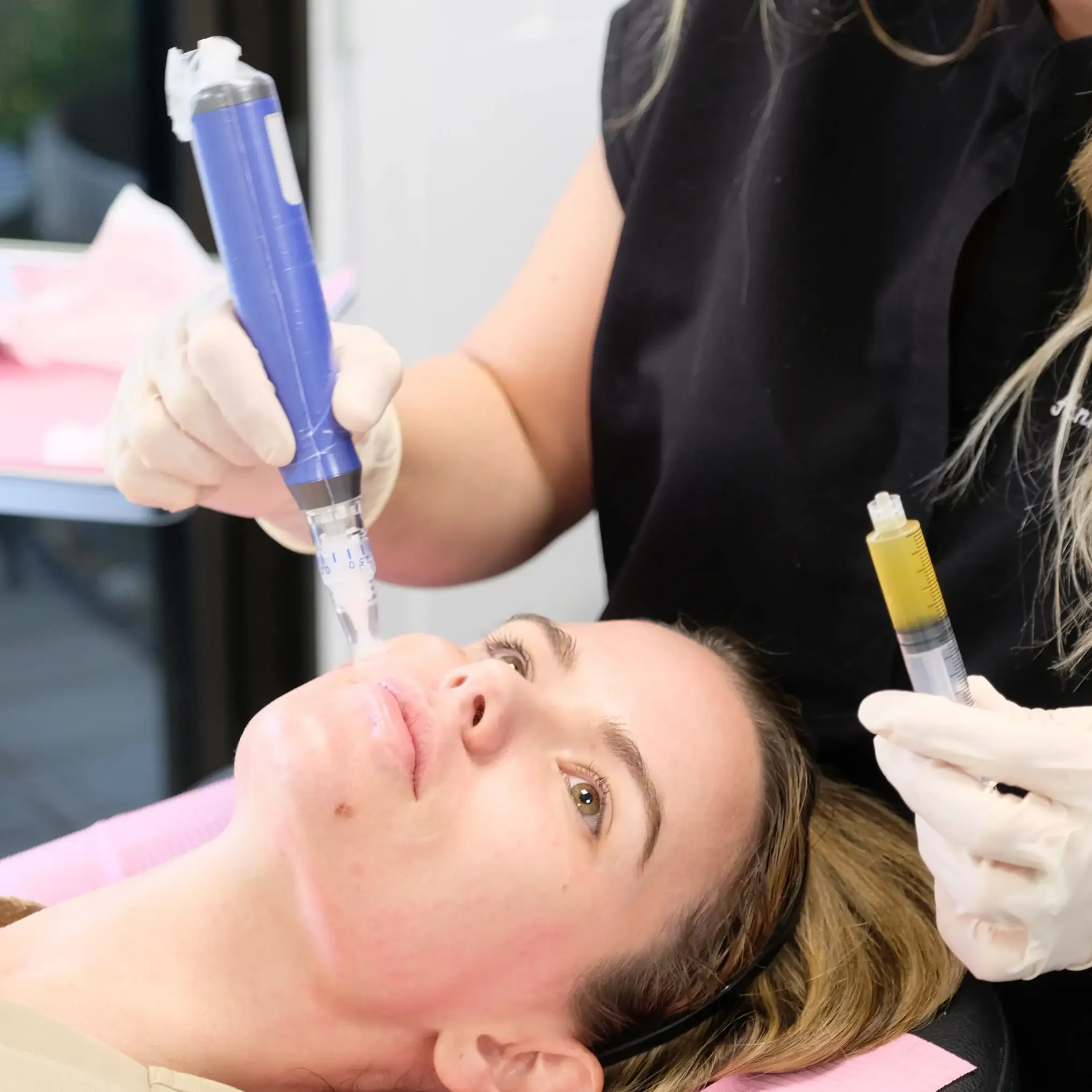 Microneedling In Greenwood Village & Parker CO