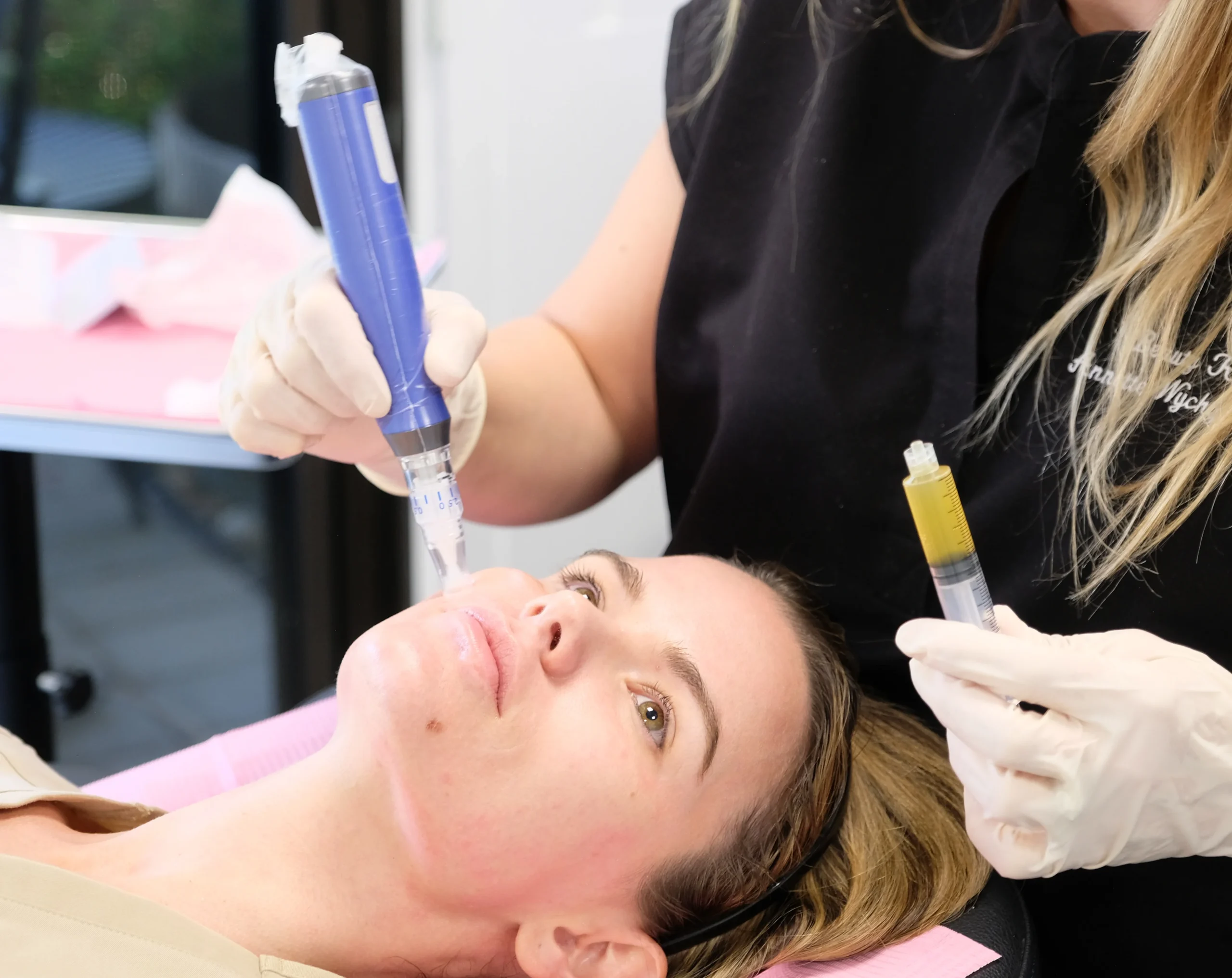 Microneedling In Greenwood Village & Parker CO