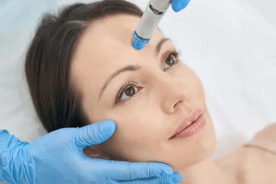 Woman receiving a HydraFacial treatment on her forehead from an esthetician.