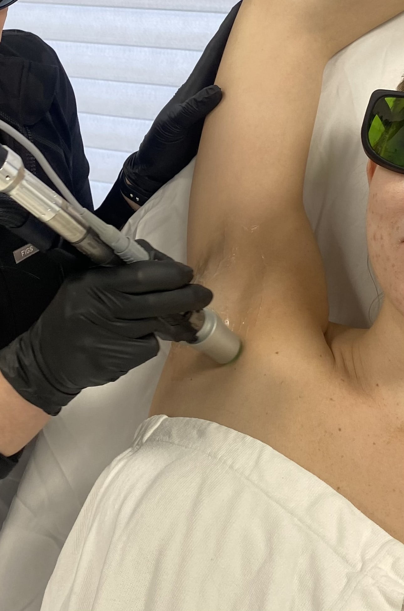 Chrome Laser Hair Removal by Beauty Refined